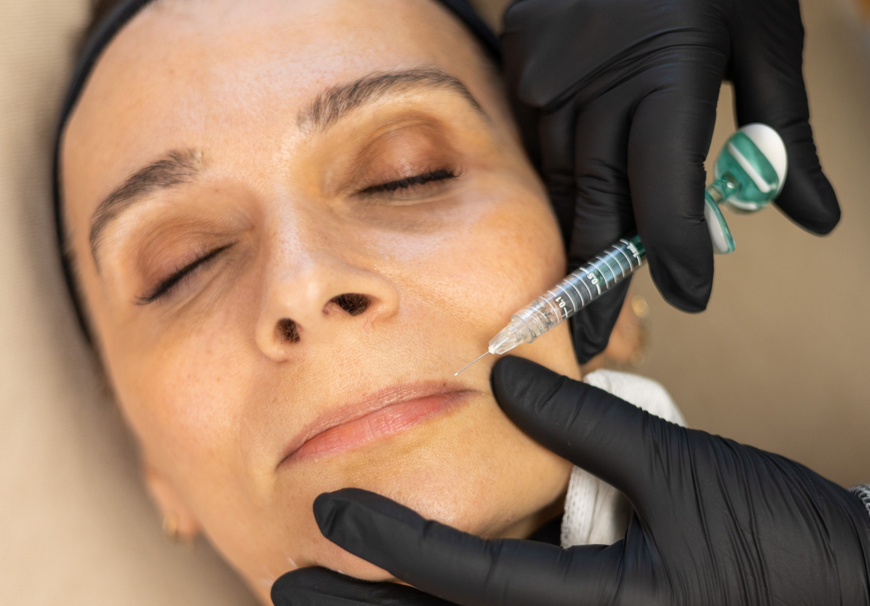 Un influenceur obtient le retrait de ses injections aux lèvres pris en charge par la Sécurité sociale